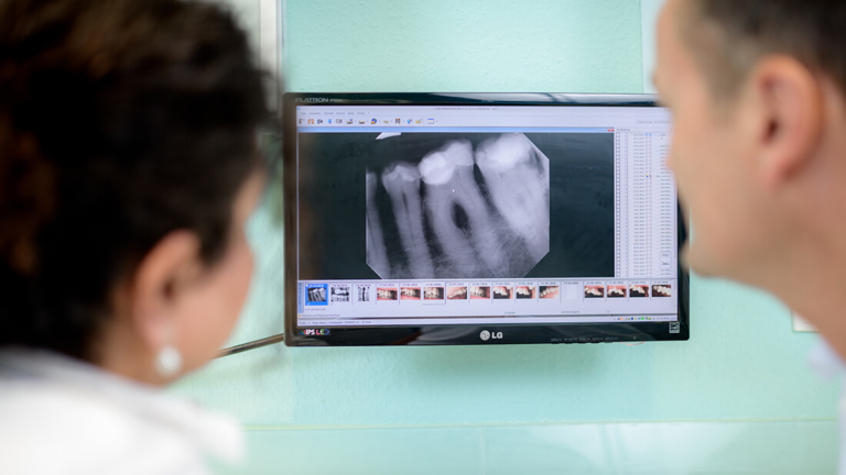 Zahnarzt Meerbusch – Nazer – Leistungen – Endodontie Zahnarzt Meerbusch, Leistungen